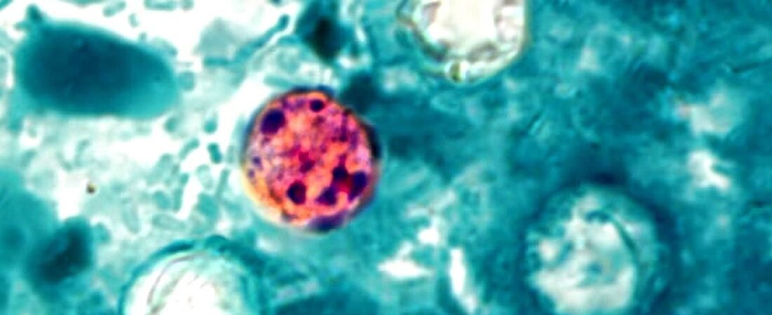 WA health expert explains cyclospora safety
