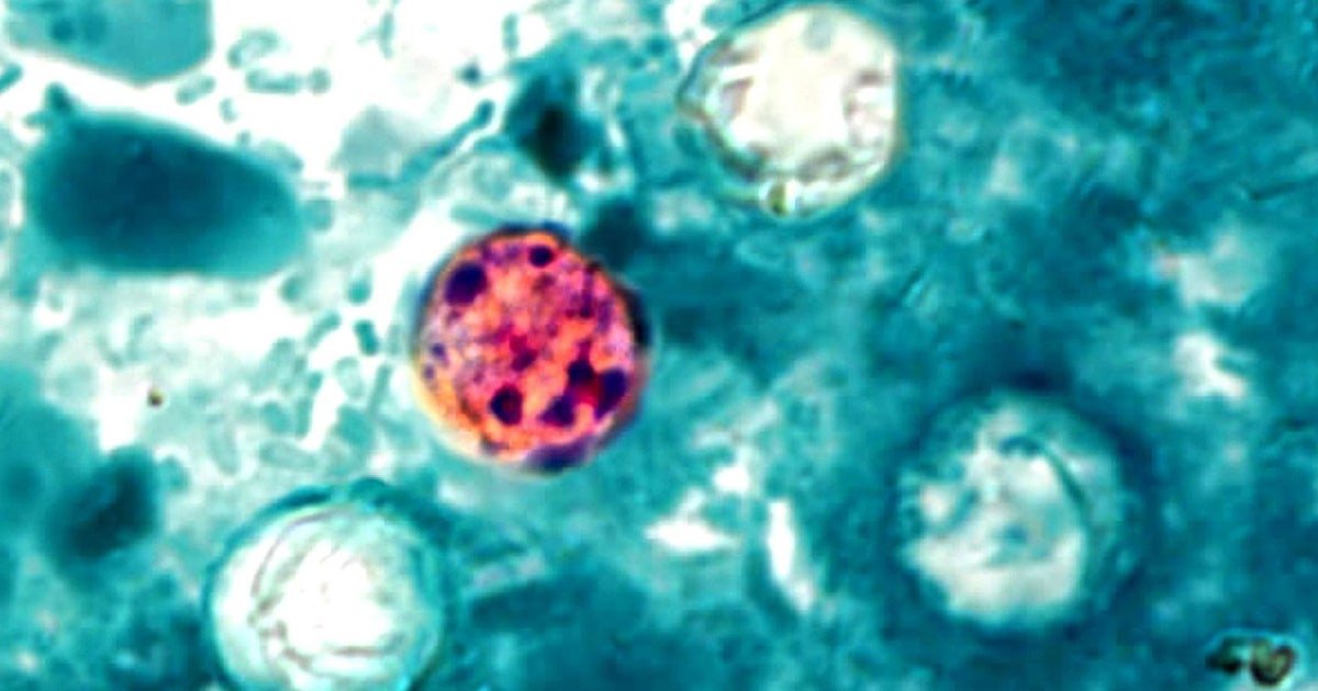 WA health expert explains cyclospora safety